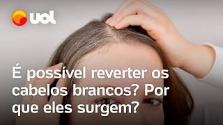 Cabelo branco é possível reverter Estresse sono irregular e má alimentação influenciam confira [upl. by Renell]