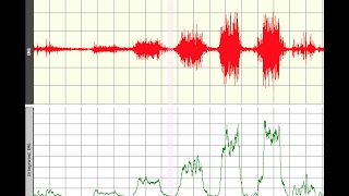 EMG recording and data collection [upl. by Sairu]