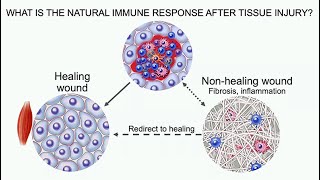 The Immune System in Regenerative Medicine [upl. by Map]