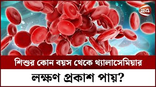 শিশুর কোন বয়স থেকে থ্যালাসেমিয়ার লক্ষণ প্রকাশ পায়  Thalassemia Symptoms  Channel 24 [upl. by Karlotte]