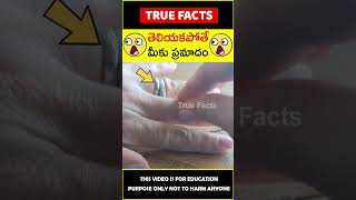 Eyelid twitching explained interstingfacts 😲మీకు ప్రమాదం😲 amazingfacts truefacts shorts [upl. by Rillings]