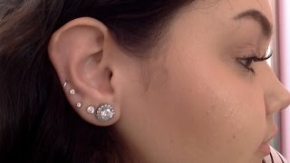 UPDATED Ear Keloid Removal  Amanda Mazzola [upl. by Nimad239]