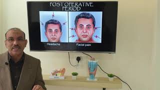 Deviated nasal septum Hindi Patient teaching programme [upl. by Zehcnas]