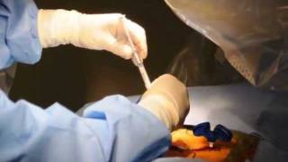 Vertebroplasty Live Procedure Hussien ElMaghraby [upl. by Nell]