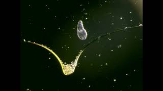 Protists and a bdelloid  rotifer  Raw vid I [upl. by Joliet110]