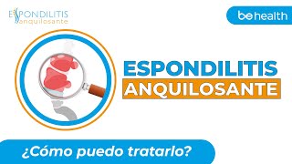 TRATAMIENTOS PARA LA ESPONDILITIS ANQUILOSANTE [upl. by Mis]