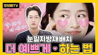 1석2조 효과 눈밑지방재배치랑 함께 하면 좋은 수술과 시술 알려드립니다  오브제성형외과 장욱 원장 [upl. by Cohberg]