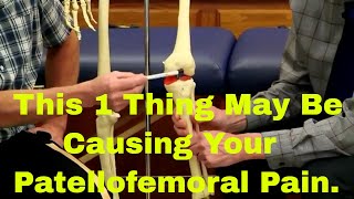 This 1 Thing May Be Causing Your Patellofemoral PainCorrect it NOW [upl. by Aitak]