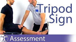 Tripod Sign  Hamstring Contractures [upl. by Wollis]