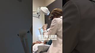 Yellow Laser for pigment and vessels skin aestheticdermatology cosmeticprocedure dermatology [upl. by Hayward]