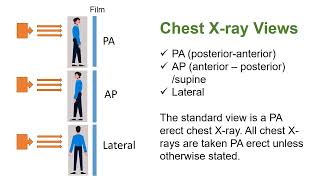 Different Types of Chest X ray Views [upl. by Beatrix]