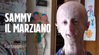 Sammy Basso una vita con la progeria quotStudio una ricerca per fare del bene agli altriquot [upl. by Jamnes]