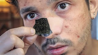 I try VIRAL NOSE PORE STRIPS and THIS HAPPENED 😲 [upl. by Frost]