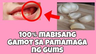 MABISANG GAMOT sa pamamaga ng gumsgilagid [upl. by Eidaj]