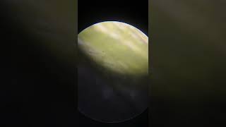 Spirogyra under microscope youtubeshorts viralvideo viralshorts recommended [upl. by Rehc]