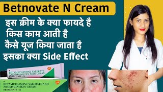 Betamethasone Valerate and Neomycin Skin Cream  Betnovate N Cream for Face  Uses [upl. by Hinckley]