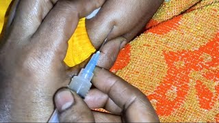 Intramuscular arms injectionIm cefepime Xemimax 500mginjection video 24 P33 by cannula 69 [upl. by Otrepur]