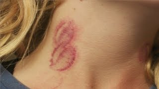 learn how to give a hickey easy [upl. by Chil]