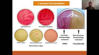 Classification of Enterobacteriaceae  Biochemical identification and complications [upl. by Lagiba]