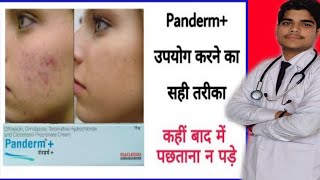 panderm cream review  panderm plus lagane se kya hota hai  penderm [upl. by Lira622]