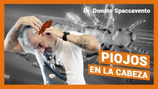 PIOJOS en la CABEZA  10 MITOS Y VERDADES sobre la PEDICULOSIS [upl. by Jeannie]