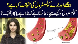 What is the reality of Good and Bad cholesterol  Dr Sahar Chawla [upl. by Anes252]