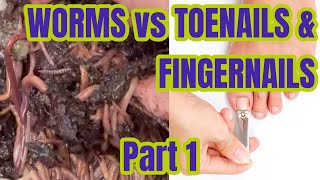 Worms vs Toenails amp Fingernails  Part 1 [upl. by Burd]