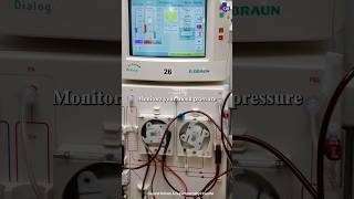 How does a Dialysis Machine Work [upl. by Alec]