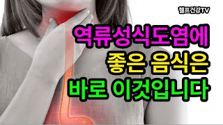 역류성식도염에 좋은 음식 역류성식도염 esophagitis [upl. by Barboza]