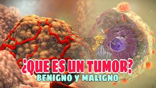 ✅Qué es un TUMOR Tipos Causas Síntomas Tratamiento✅ [upl. by Andrea886]