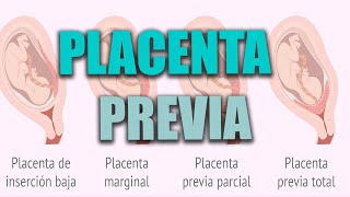 PLACENTA PREVIA en el embarazo placenta baja ¿Qué es ¿Cómo afecta al parto la placenta previa [upl. by Gans]