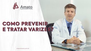 Como Prevenir e Tratar Varizes Dá para evitar [upl. by Ahnavas]