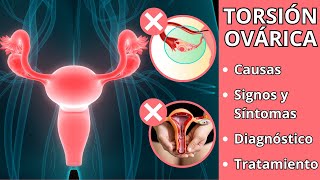 ¿Qué es la TORSIÓN OVÁRICA  Causas signos y síntomas diagnóstico y tratamiento [upl. by Bordie438]