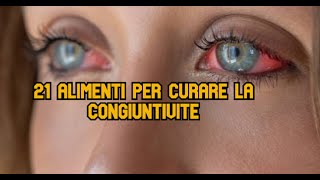 21 Alimenti per curare la congiuntivite [upl. by Maguire]