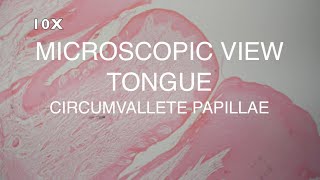 MICROSCOPIC VIEW  TONGUE CIRCUMVALLATE PAPILLAE [upl. by Imogen]