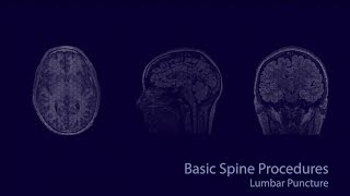 Basic neuroradiology procedures part 2  Lumbar puncture [upl. by Clower]