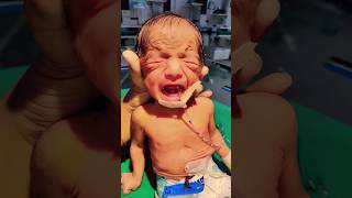 Preterm newborn baby 🙏❤️🙏shortvideotrendingviralyoutubeshortsbabysongshortsdivyaverma2401 [upl. by Aruasor251]