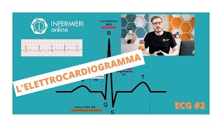 COS E L ELETTROCARDIOGRAMMA E COSA CI DICE  ECG 02  INFERMIERI online [upl. by Enirtak623]