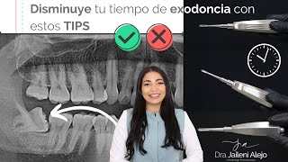 DISMINUYE TU TIEMPO DE EXODONCIA CON ESTOS TIPS [upl. by Oivat]