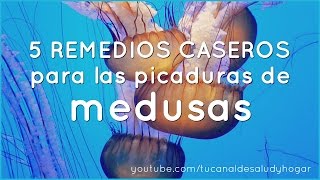 5 Remedios Caseros para las picaduras de medusas [upl. by Bendite864]