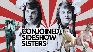 The Bizarre Story of Conjoined Sisters Daisy and Violet Hilton conjoinedtwins sideshow [upl. by Alekal]