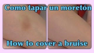 Como cubrir un moretón ♡ How to cover a bruise [upl. by Yesnnyl9]