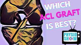 Which ACL Graft Is Best For Returning to Sport [upl. by Moth]