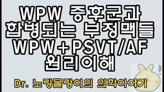 WPW syndromeWPW 증후군 합병 부정맥 WPW with PSVT WPW with Atrial fibrillation 원리 [upl. by Gilliette198]