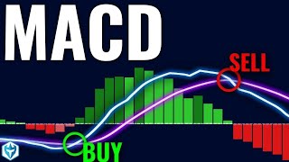 How I Nailed Trading with the MACD Indicator StepbyStep Guide [upl. by Engedi]