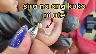 Vlog 1091Dry SkinIngrown Removal PEDICURE 991 [upl. by Orban]