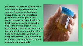 Examination of Urine in clinical pathology basic knowledge for MLT beginner students [upl. by Nolita593]