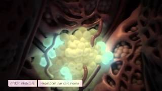 Medical Animation Liver Fibrosis and Cancer Oncology Animation [upl. by Barthol]