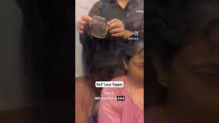 Hair thinning solution  hide receding hairline  Hair loss solutions for women  Real Hair toppers [upl. by Roer]