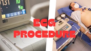 ECG  Procedure of ECG  Fundamental of Nursing  medjeenius youtubevideo nursing [upl. by Icul]